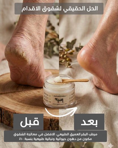 مرطب الشحوم البقرية العميق للتشققات