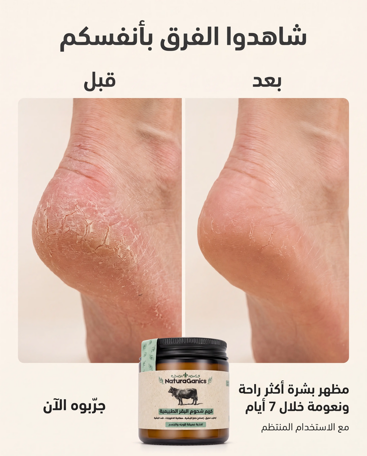 كريم التالو الطبيعي للجفاف والشقوق